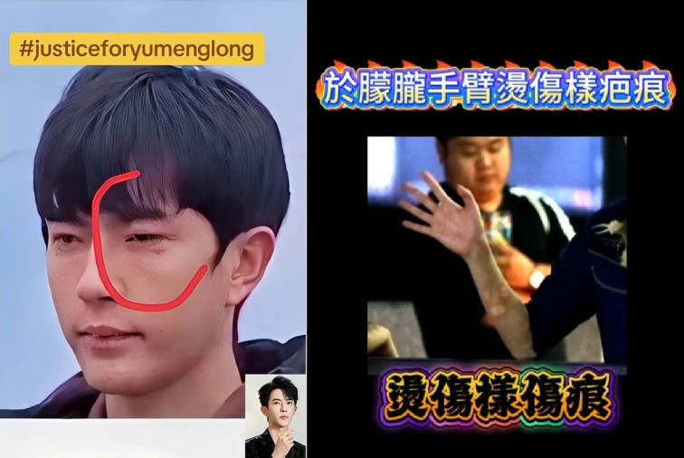 Yu Menglong Often Faced Abuse During His Life, and Images That Have Emerged Online Have Left Many in Tears