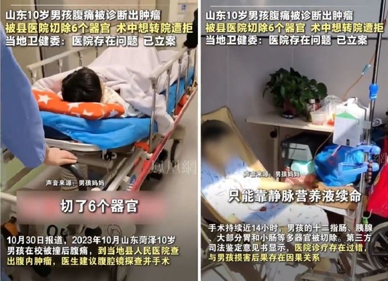 Doctor Turns Killer: 10-Year-Old Boy in Shandong Has Six Organs Removed After Abdominal Pain