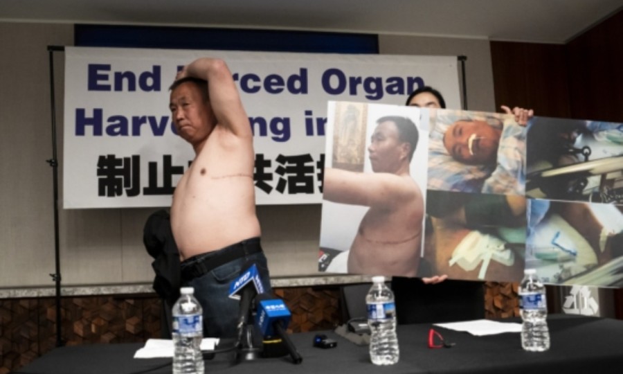 A Chilling Thought! A Malaysian Tourist in Fujian s Brain-Dead Organ Donation.